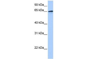 WB Suggested Anti-ZNF417 Antibody Titration:  0.