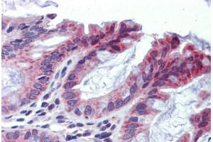 Human Colon (formalin-fixed, paraffin-embedded) stained with TULP2 antibody ABIN462210 followed by biotinylated goat anti-rabbit IgG secondary antibody ABIN481713, alkaline phosphatase-streptavidin and chromogen. (TULP2 antibody  (N-Term))