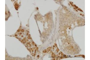 Immunoperoxidase of monoclonal antibody to C10orf7 on formalin-fixed paraffin-embedded human testis.