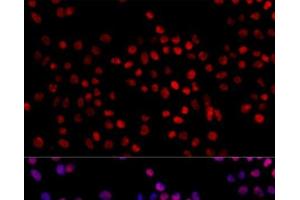 Immunofluorescence analysis of 293T cells using XRCC4 Polyclonal Antibody at dilution of 1:100. (XRCC4 antibody)
