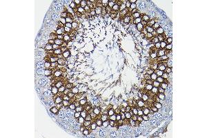 Immunohistochemistry of paraffin-embedded rat testis using ICMT Rabbit pAb (ABIN6128077, ABIN6142129, ABIN6142130 and ABIN6214491) at dilution of 1:200 (40x lens). (ICMT antibody  (AA 175-284))