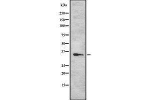 Western blot analysis Sarcoglycan-β using Jurkat whole cell lysates