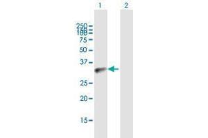 Western Blot analysis of BCL11A expression in transfected 293T cell line by BCL11A MaxPab polyclonal antibody.