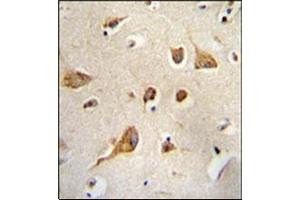 Formalin Fixed, Paraffin Embedded Human brain tissue stained with Kif5C-2 Antibody followed by peroxidase conjugation of the secondary antibody and DAB staining. (KIF5C antibody)