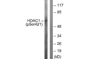 Western blot analysis of extracts from Jurkat cells, treated with EGF (200ng/ml, 30mins), using HDAC1 (Phospho-Ser421) antibody. (HDAC1 antibody  (pSer421))