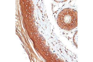 Immunohistochemistry of paraffin-embedded rat skin using PERP Rabbit mAb (ABIN7270861) at dilution of 1:100 (40x lens). (PERP antibody)