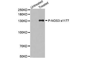 Western blot analysis of extracts of various cell lines, using Phospho-NOS3-S1177 antibody (ABIN2988223). (ENOS antibody  (pSer1177))