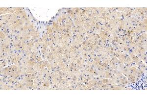 Immunohistochemistry (IHC) image for anti-Tumor Necrosis Factor alpha (TNF alpha) (AA 71-234) antibody (ABIN7427294)