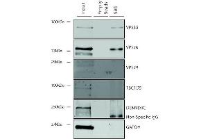 Immunoprecipitation analysis using Mouse Anti-VPS35 Monoclonal Antibody, Clone 5A9 (ABIN6932951). (VPS35 antibody  (HRP))