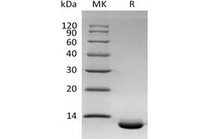 Western Blotting (WB) image for Chemokine (C-X-C Motif) Ligand 6 (CXCL6) protein (His tag) (ABIN7319813) (CXCL6 Protein (His tag))