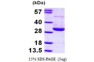 SDS-PAGE (SDS) image for RAN, Member RAS Oncogene Family (RAN) (AA 1-216) protein (His tag) (ABIN667788)