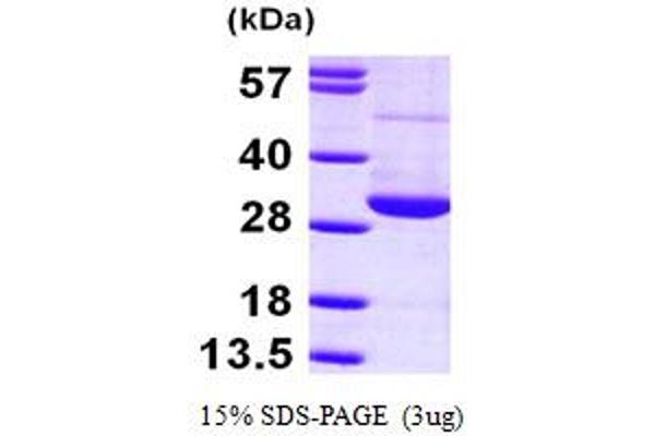 RAN Protein (AA 1-216) (His tag)