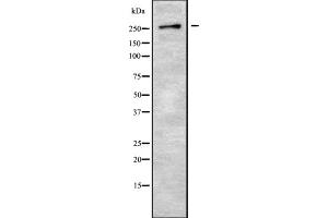 Western blot analysis GPR179 using 293 whole cell lysates