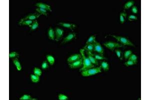 Immunofluorescent analysis of HepG2 cells using ABIN7143728 at dilution of 1:100 and Alexa Fluor 488-congugated AffiniPure Goat Anti-Rabbit IgG(H+L) (Iba1 antibody  (AA 2-147))