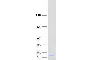 Validation with Western Blot (PPIH Protein (Myc-DYKDDDDK Tag))