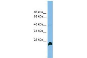 Image no. 1 for anti-Peptidylprolyl Isomerase H (Cyclophilin H) (PPIH) (AA 35-84) antibody (ABIN6744942) (PPIH antibody  (AA 35-84))