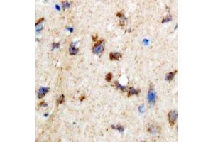 Immunohistochemical analysis of SKIP staining in rat brain formalin fixed paraffin embedded tissue section. (SKIP antibody)