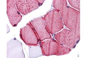 Immunohistochemistry (IHC) image for anti-Wingless-Type MMTV Integration Site Family, Member 5B (WNT5B) (Middle Region) antibody (ABIN2776725) (WNT5B antibody  (Middle Region))