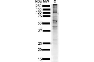 Western Blot analysis of Mouse Brain showing detection of Alpha Synuclein pSer129 protein using Rabbit Anti-Alpha Synuclein pSer129 Monoclonal Antibody, Clone J18 (ABIN6932878). (SNCA antibody  (pSer129) (FITC))