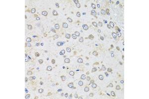 Immunohistochemistry of paraffin-embedded rat brain using Albumin antibody (ABIN3020953, ABIN3020954, ABIN3020955 and ABIN6213817) at dilution of 1:100 (40x lens). (Albumin antibody  (AA 20-255))