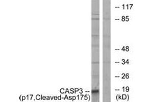 Western blot analysis of extracts from COLO cells, using Caspase 3 (p17,Cleaved-Asp175) Antibody. (Caspase 3 antibody  (Cleaved-Asp175))