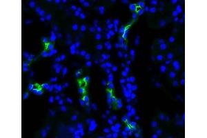 Immunohistochemistry analysis using Rabbit Anti-Aquaporin 2 Polyclonal Antibody . (AQP2 antibody  (C-Term) (Biotin))