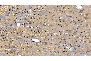 Immunohistochemistry (IHC) image for anti-Receptor (TNFRSF)-Interacting serine-threonine Kinase 1 (RIPK1) (AA 17-289) antibody (ABIN7441202)
