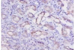 Immunohistochemistry of paraffin-embedded human kidney tissue using ABIN7178829 at dilution of 1:20 (Cathepsin K antibody  (AA 115-329))