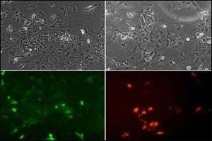 ES cells were transiently transfected with Flag-tagged mouse NeuroD1 (tagged on N-term), fixed 24h post transfection and stained for flag tag (red) to check expression. (NEUROD1 antibody  (AA 15-45))