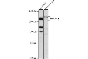 Western blot analysis of extracts of various cell lines, using KCNC4 antibody (ABIN7269488) at 1:1000 dilution. (Kv3.4 antibody  (AA 490-538))