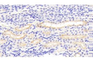 Detection of MMP3 in Porcine Kidney Tissue using Polyclonal Antibody to Matrix Metalloproteinase 3 (MMP3) (MMP3 antibody  (AA 18-477))