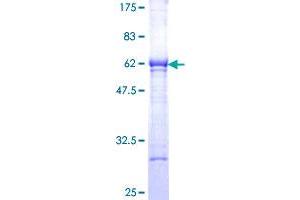 Esterase D Protein (ESD) (AA 1-282) (GST tag)