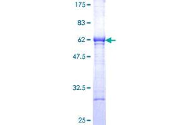 Esterase D Protein (ESD) (AA 1-282) (GST tag)