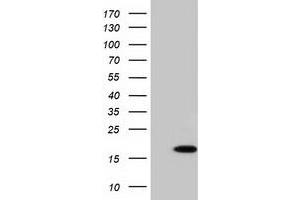 HEK293T cells were transfected with the pCMV6-ENTRY control (Left lane) or pCMV6-ENTRY C10orf82 (Right lane) cDNA for 48 hrs and lysed. (C10orf82 antibody)