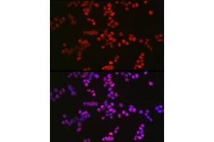 Immunofluorescence analysis of F9 cells using TET2 Rabbit pAb (ABIN7270780) at dilution of 1:100 (40x lens). (TET2 antibody)