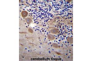 Immunohistochemistry (IHC) image for anti-Signal Sequence Receptor, beta (Translocon-Associated Protein Beta) (SSR2) antibody (ABIN2997190) (SSR2 antibody)
