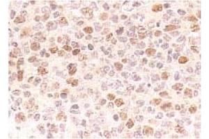Immunohistochemistry (IHC) image for anti-Cell Division Cycle 7 (CDC7) antibody (ABIN487481) (CDC7 antibody)