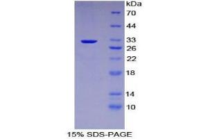 SDS-PAGE (SDS) image for Kruppel-Like Factor 4 (Gut) (KLF4) (AA 240-478) protein (His tag) (ABIN1879719) (KLF4 Protein (AA 240-478) (His tag))
