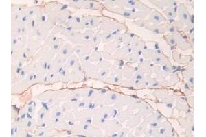 Detection of FBN1 in Mouse Heart Tissue using Polyclonal Antibody to Fibrillin 1 (FBN1) (Fibrillin 1 antibody  (AA 1703-1889))