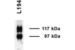 Western blot analysis of Rat Inner medulla showing detection of UT-A1 protein using Rabbit Anti-UT-A1 Polyclonal Antibody . (Solute Carrier Family 14 (Urea Transporter, Kidney) Member 2 (SLC14A2) (AA 911-929) antibody (Atto 594))