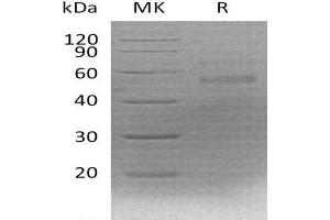 Western Blotting (WB) image for Coagulation Factor X (F10) protein (His tag) (ABIN7320491) (Coagulation Factor X Protein (F10) (His tag))