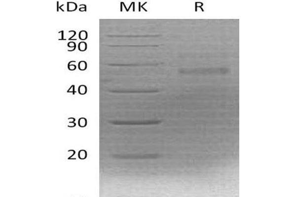 Coagulation Factor X Protein (F10) (His tag)