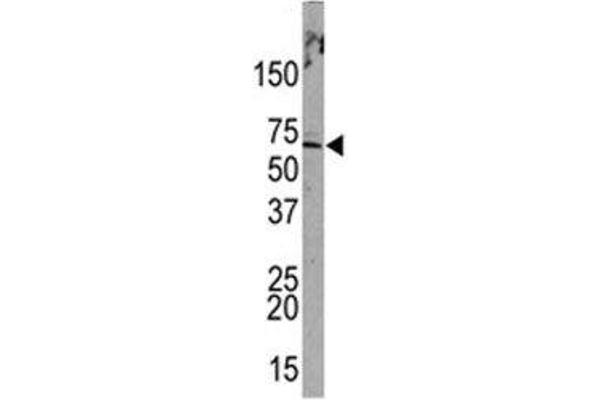 PML antibody  (Sumoylation Site)