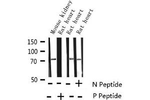 Western blot analysis of Phospho-Tau (Thr231) expression in various lysates (MAPT antibody  (pThr231))