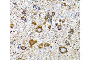 Immunohistochemistry of paraffin-embedded Mouse spinal cord using MAP1LC3A Polyclonal Antibody at dilution of 1:100 (40x lens). (MAP1LC3A antibody)