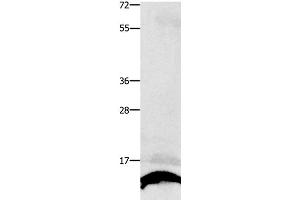 Western Blot analysis of Human liver cancer tissue using COX5B Polyclonal Antibody at dilution of 1:250 (COX5B antibody)