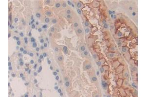 DAB staining on IHC-P; Samples: Human Kidney Tissue (KIR2DS2 antibody  (AA 22-304))