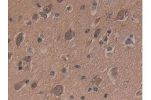 Detection of dSIP in Human Brain Tissue using Polyclonal Antibody to Delta-Sleep Inducing Peptide (dSIP) (dSIP (AA 1-134) antibody)