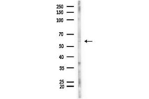 Western blot analysis of lysates from Mouse liver, using Phospho-PPAR gamma (Ser273) Antibody at 1/1000 dilution.