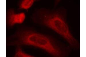 Immunofluorescence staining of methanol-fixed HeLa cells using Phospho-STAT1-S727 antibody (ABIN2988310).